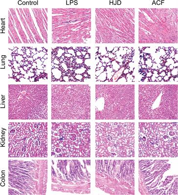 The interaction of MD-2 with small molecules in huanglian jiedu decoction play a critical role in the treatment of sepsis